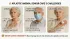 Aplastic Anemia and Senior Living: When Severe Blood Disorders Require Structured Care