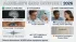 How AI Detects Dementia Years Before Symptoms
