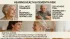 Hearing Loss: The #1 Preventable Cause of Dementia