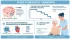 Multi-Infarct Dementia and Memory Care: When Multiple Small Strokes Lead to Cognitive Decline